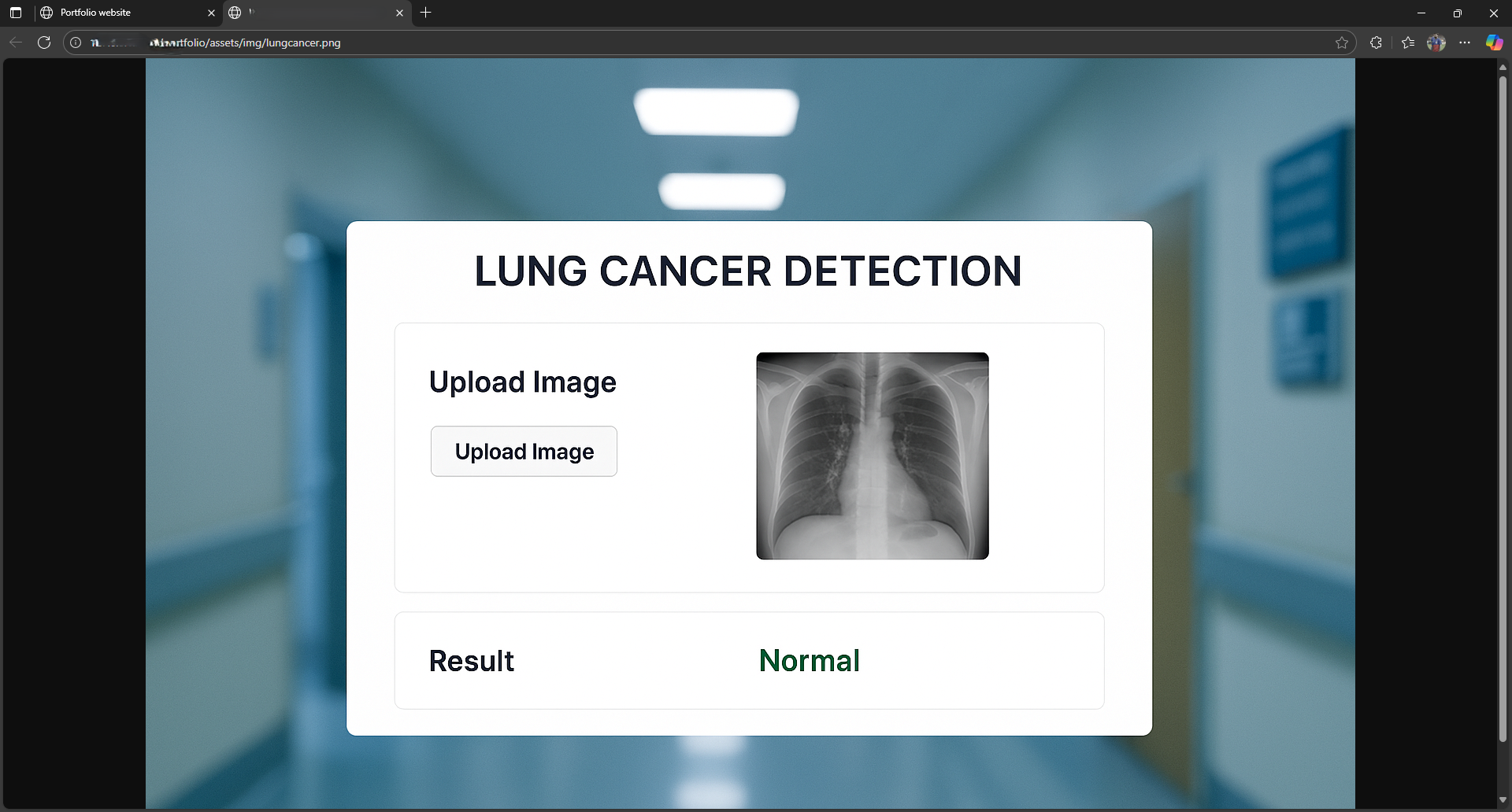 Lung Cancer Detection